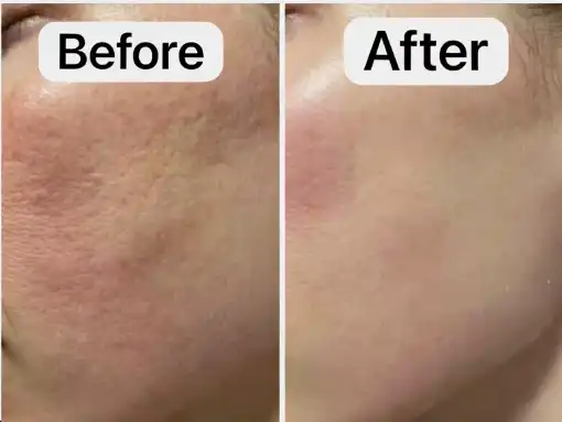 native collagen powder