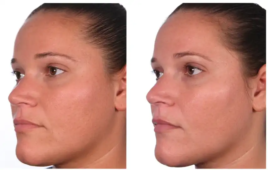 native collagen powder native collagen powder