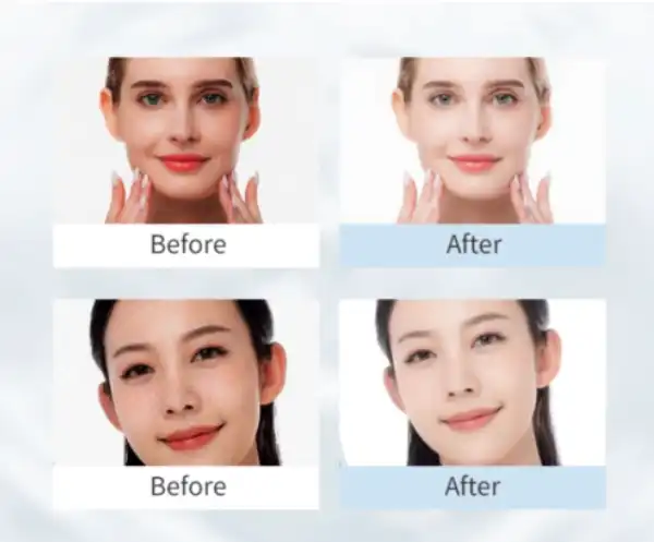 L-Ascorbic Acid: Skin Benefits?