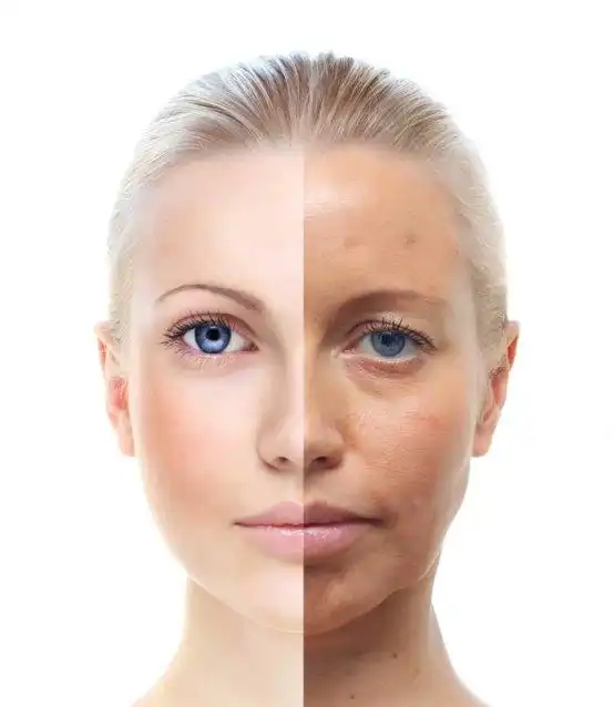 Can Collagen with Peptides Powder Turn Back Time on Aging?